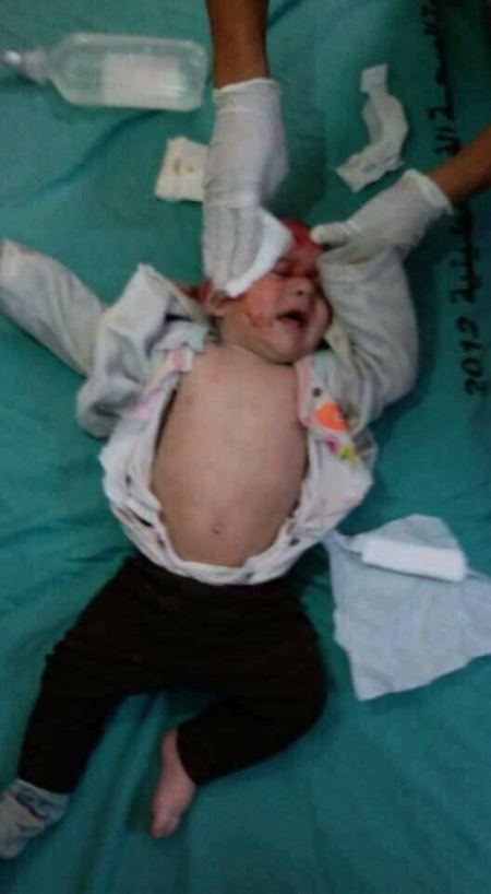 جرحى جراء قصف الاحتلال لمواقع المقاومة شمال قطاع غزة